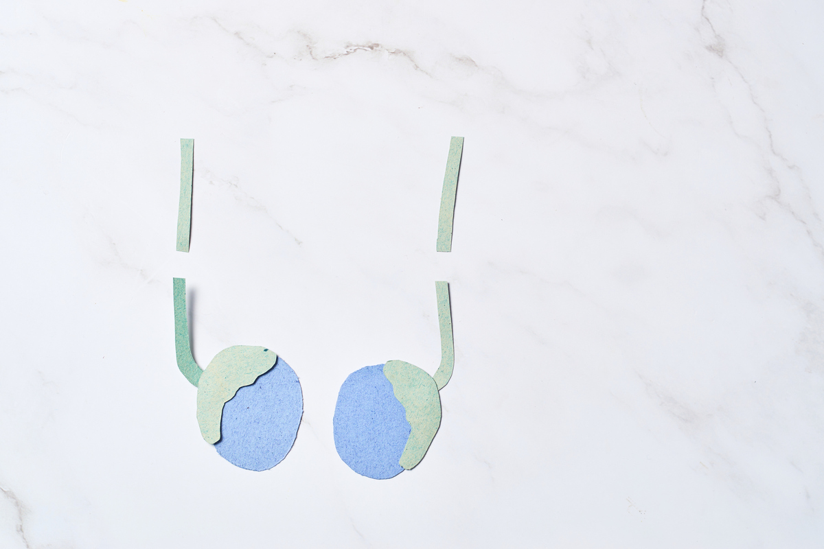 vasectomy, men's health and well being.